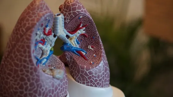 Lung cancer risk assessment calculator